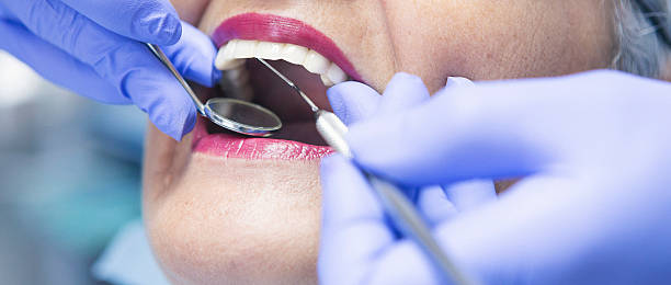 Best Emergency Treatment for Dental Infections or Abscesses in Crisfield, MD